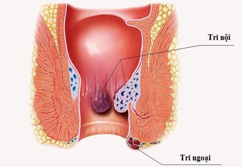 Cây từ bi có tác dụng tiêu trĩ