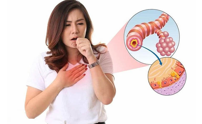 Điều trị viêm phế quản, ho ra cấp tính 