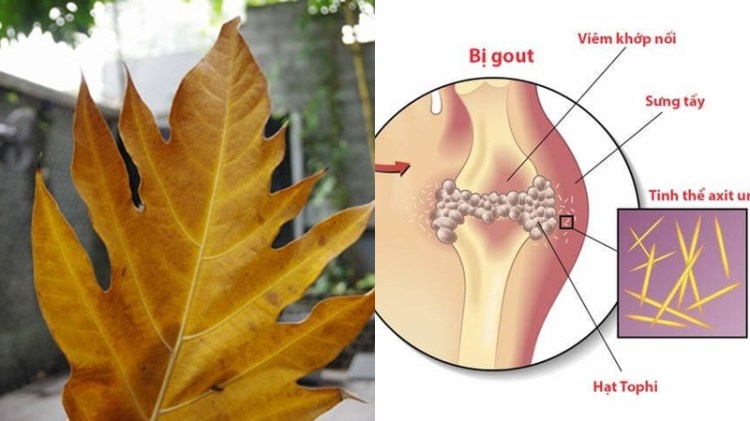 Lá sa kê là dược liệu tốt để chữa bệnh gout