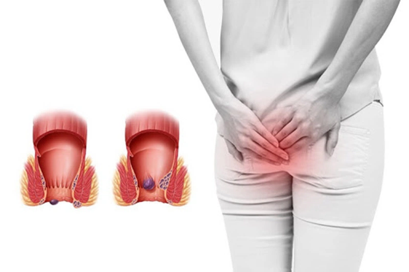 7 công dụng của lá vông nem đối với sức khỏe 5