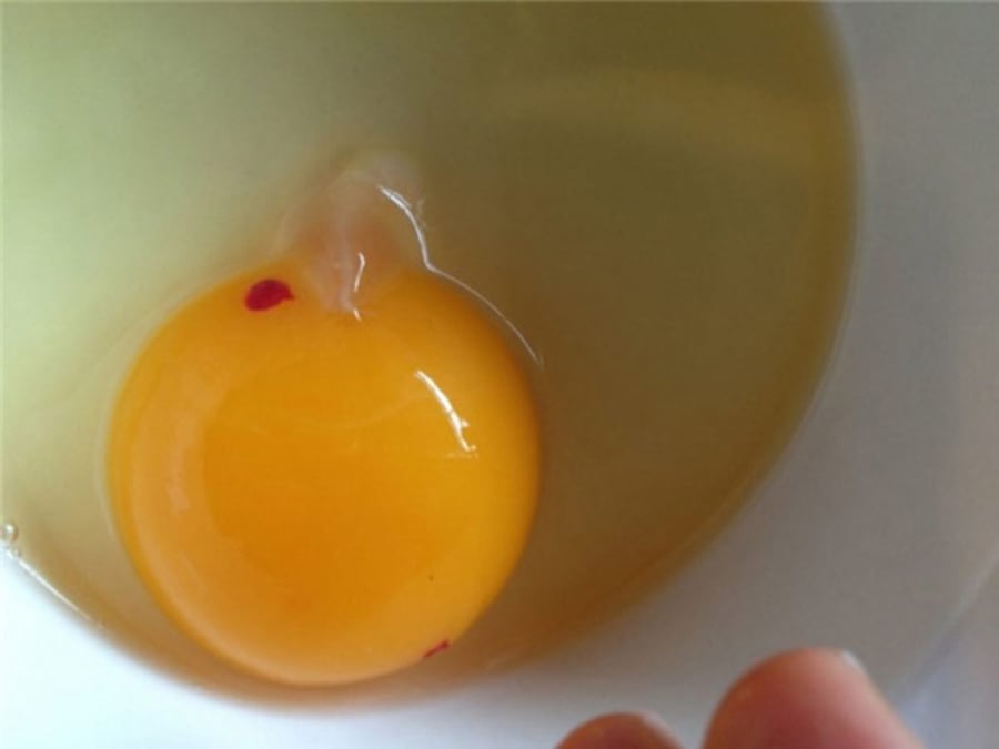 Vệt màu đỏ trong trứng gà sống