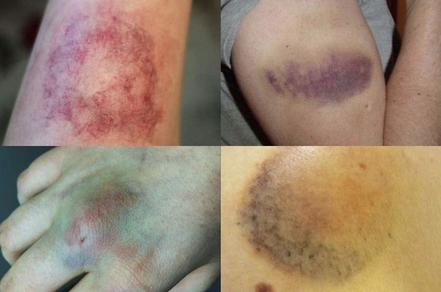 Nếu trong người có ung thư, 5 bộ phận này sẽ chuyển sang màu đen, tiếc rằng ít ai để ý!- Ảnh 2.