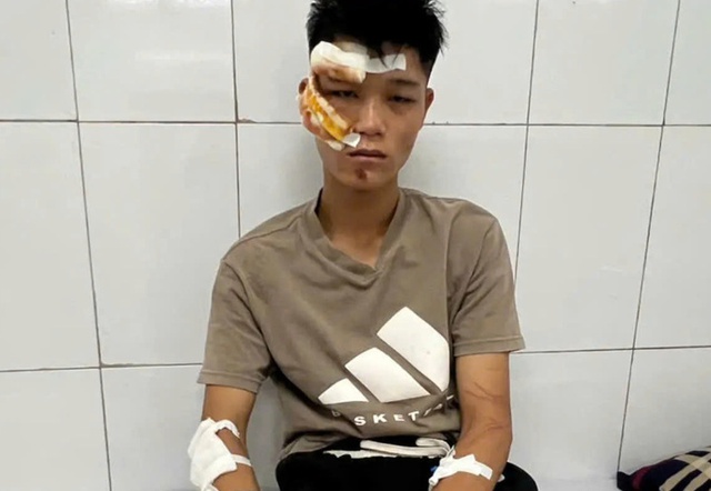 Lời khai của quái xế tông cảnh sát cơ động tại Hà Nội - Ảnh 1.