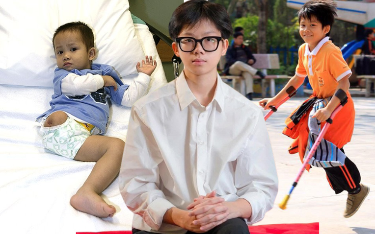 "Chú lính chì" Thiện Nhân: Từ nỗi đau thể xác của cậu bé 1 tuần tuổi bị bỏ rơi, đến chàng sinh viên 19 tuổi với suất học bổng 85%- Ảnh 1.