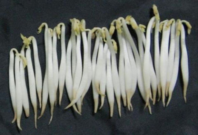 Loại rau đứng đầu danh sách “vua hại gan”, còn ăn đừng trách gan sớm hỏng- Ảnh 3.