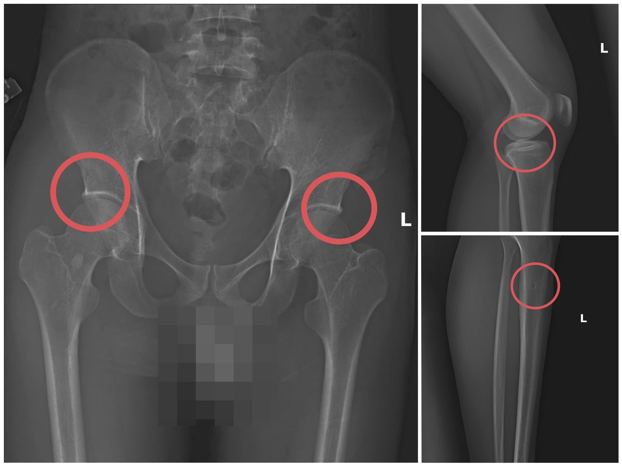 Nóng: Cựu cán bộ y tế cầm đầu đường dây tự đục vỡ xương khớp để lấy bảo hiểm- Ảnh 3.