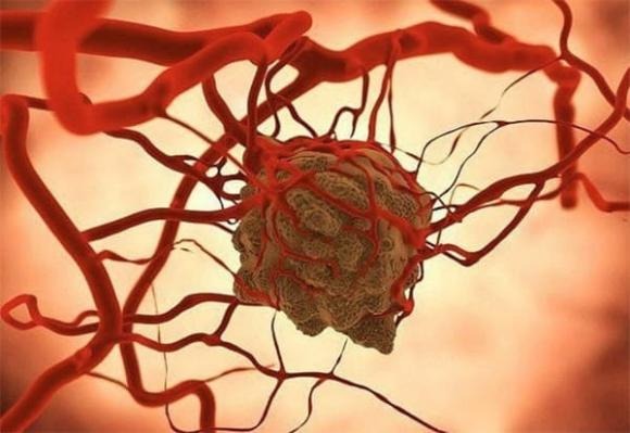 Các chuyên gia cho biḗt, cơ thể con người tṑn tại cơ chḗ “giám sát miễn dịch”, giúp nhận diện sớm và tiêu diệt những tḗ bào có dấu hiệu bất thường, bao gṑm cả tḗ bào ᴜng thư. 