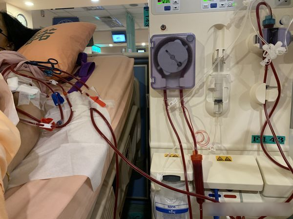 Nữ nhȃn viên văn phòng suy thận giai ᵭoạn cuṓi: Trước ᴜṓng ʟoại nước này 2 ʟần mỗi ngày, giờ chạy thận 3 ʟần/tuần- Ảnh 2.